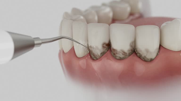 Reliable Dental Implants contractor in Bryans Road, MD by Smile Center Dentistry